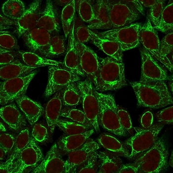 Cytokeratin 8 Antibody