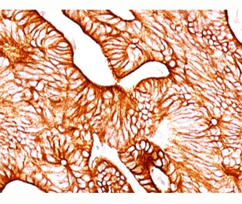 Cytokeratin 8 Antibody