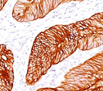 Cytokeratin 8 Antibody Cocktail