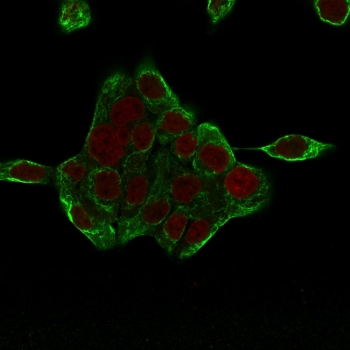 Cytokeratin 8 Antibody Cocktail