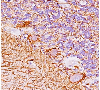 Neurofilament Antibody / Heavy