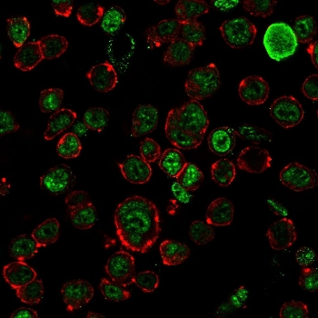 Neurofilament Antibody / Heavy