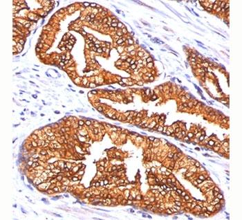 ODC-1 Antibody