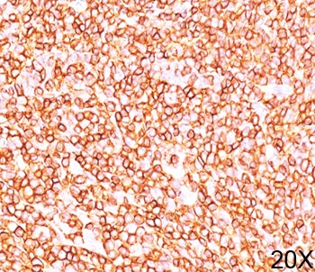 CD45RB Antibody