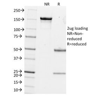 Estrogen Inducible Protein pS2 Antibody / TFF1