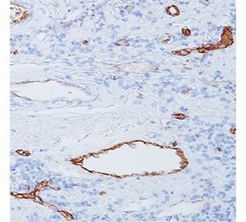 vWF Antibody / von Willebrand Factor