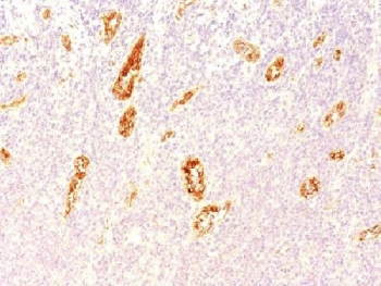 vWF Antibody / von Willebrand Factor