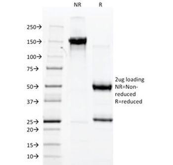 vWF Antibody / von Willebrand Factor