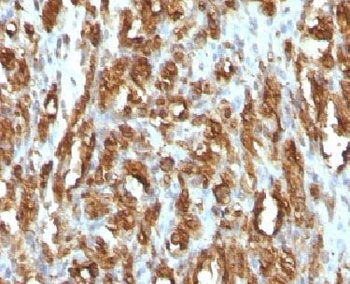 Muscle Actin Antibody (pan)