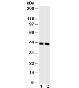 Muscle Actin Antibody (pan)