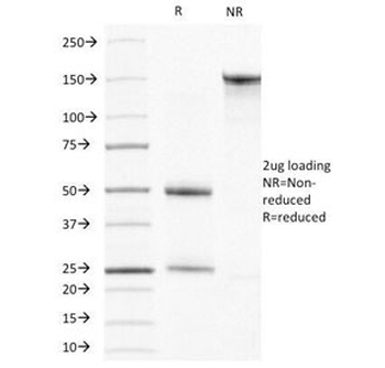 Muscle Actin Antibody (pan)
