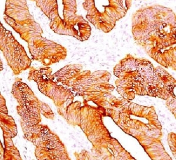Multi Cytokeratin Antibody 4/5/6/8/10/13/18