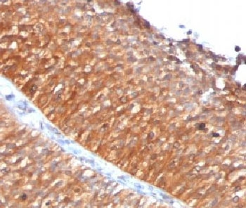 Mitochondrial Antibody