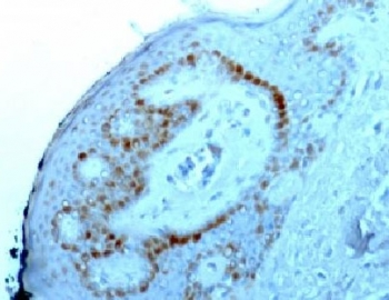 Nucleoli Marker Antibody / Human Nucleolar Antigen