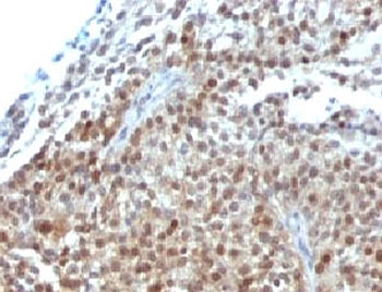 p21 Antibody Cocktail