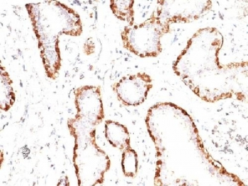 Calponin Antibody