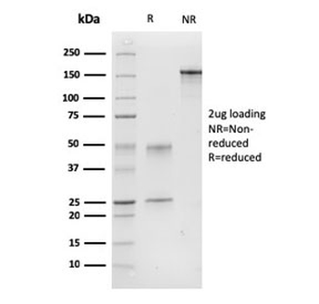 Calponin Antibody