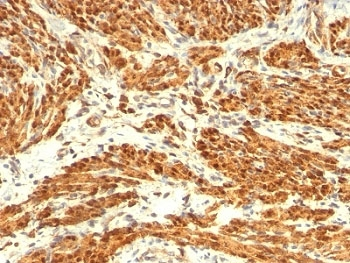 Calponin Antibody Cocktail