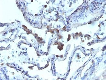 AMACR Antibody