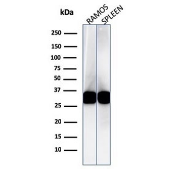 HLA-DR Antibody (MHC II)