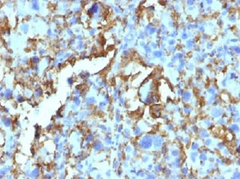 HLA-DR Antibody Cocktail (MHC II)