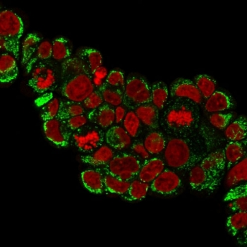 HSP60 Antibody / HSPD1