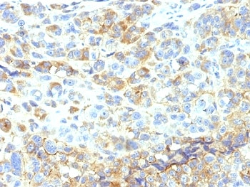 ICAM-1 Antibody / CD54