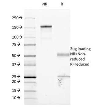 ICAM-1 Antibody / CD54