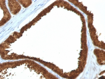 IDH1 Antibody