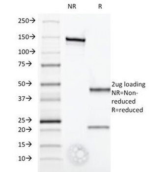 Interferon alpha Antibody