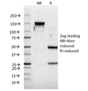 Interferon alpha 2 Antibody