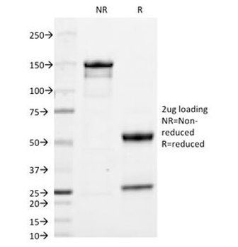 IgA Antibody