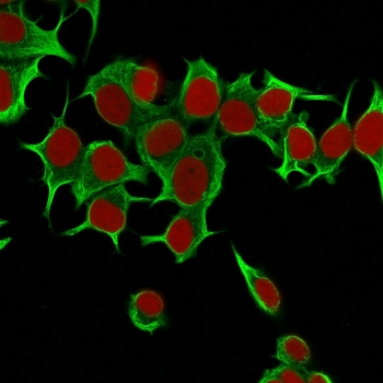 Cytokeratin 19 Antibody