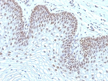 MAP3K1 Antibody