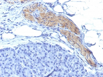 CD56 Antibody / NCAM / Extracellular domain
