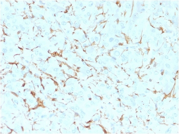 NGF Receptor Antibody