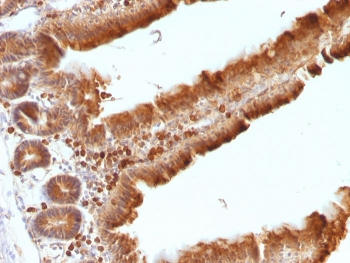 ODC Antibody / Ornithine Decarboxylase