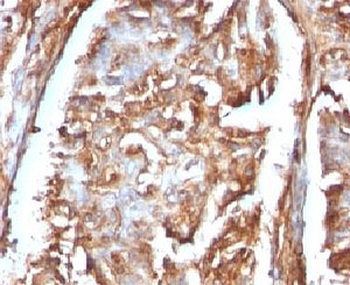 Beta-2 Microglobulin Antibody