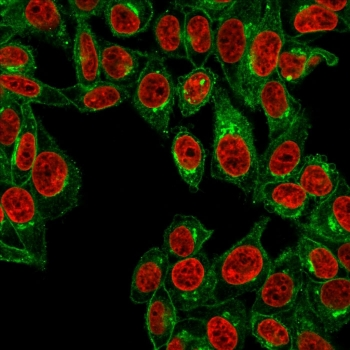 Beta-2 Microglobulin Antibody
