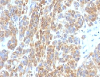 Bcl2 Antibody