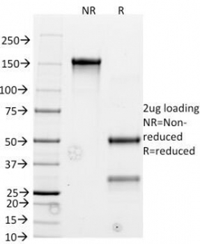 Bcl2 Antibody