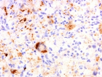 TNFa Antibody