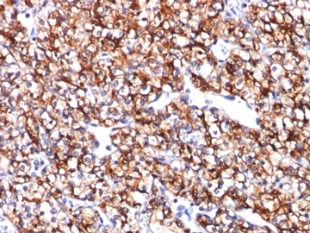 CAIX Antibody / Carbonic anhydrase IX