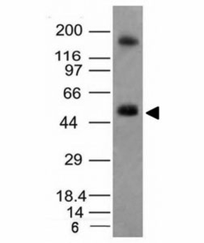CAIX Antibody / Carbonic anhydrase IX