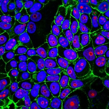 Cyclin B1 Antibody
