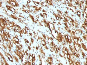 Pan Muscle Actin Antibody