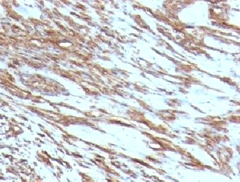 Pan Muscle Actin Antibody