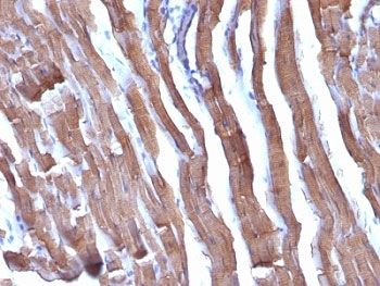 Pan Muscle Actin Antibody Cocktail