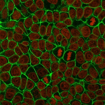 E-Cadherin Antibody