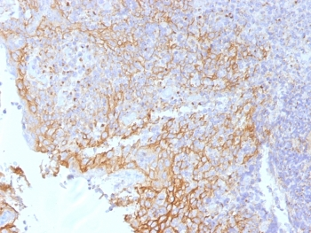 Beta Catenin Antibody